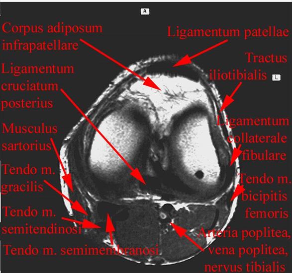 anatomia radiologiczna - 14.jpg